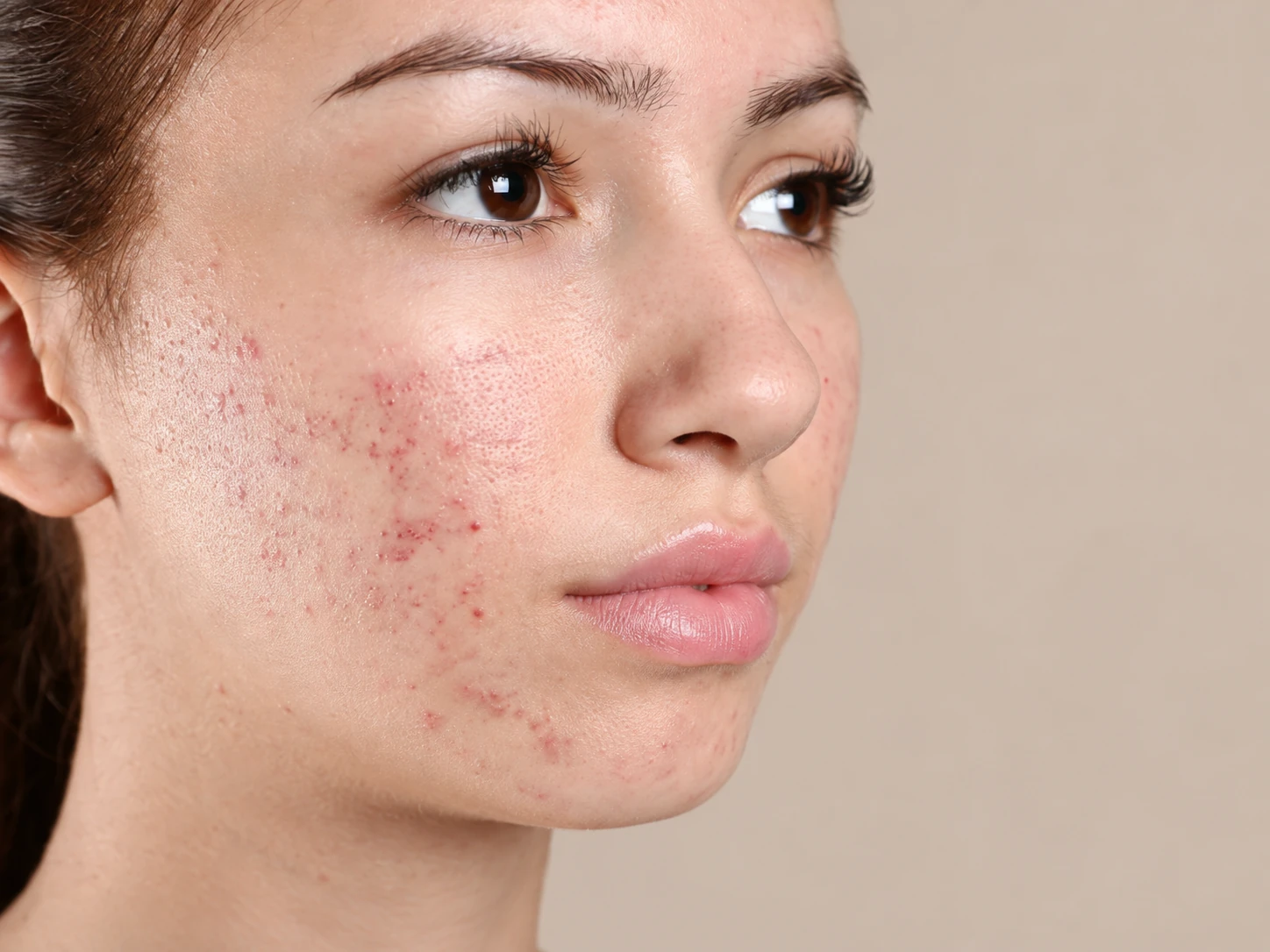 Advanced Medi-Facials, illustrative before example