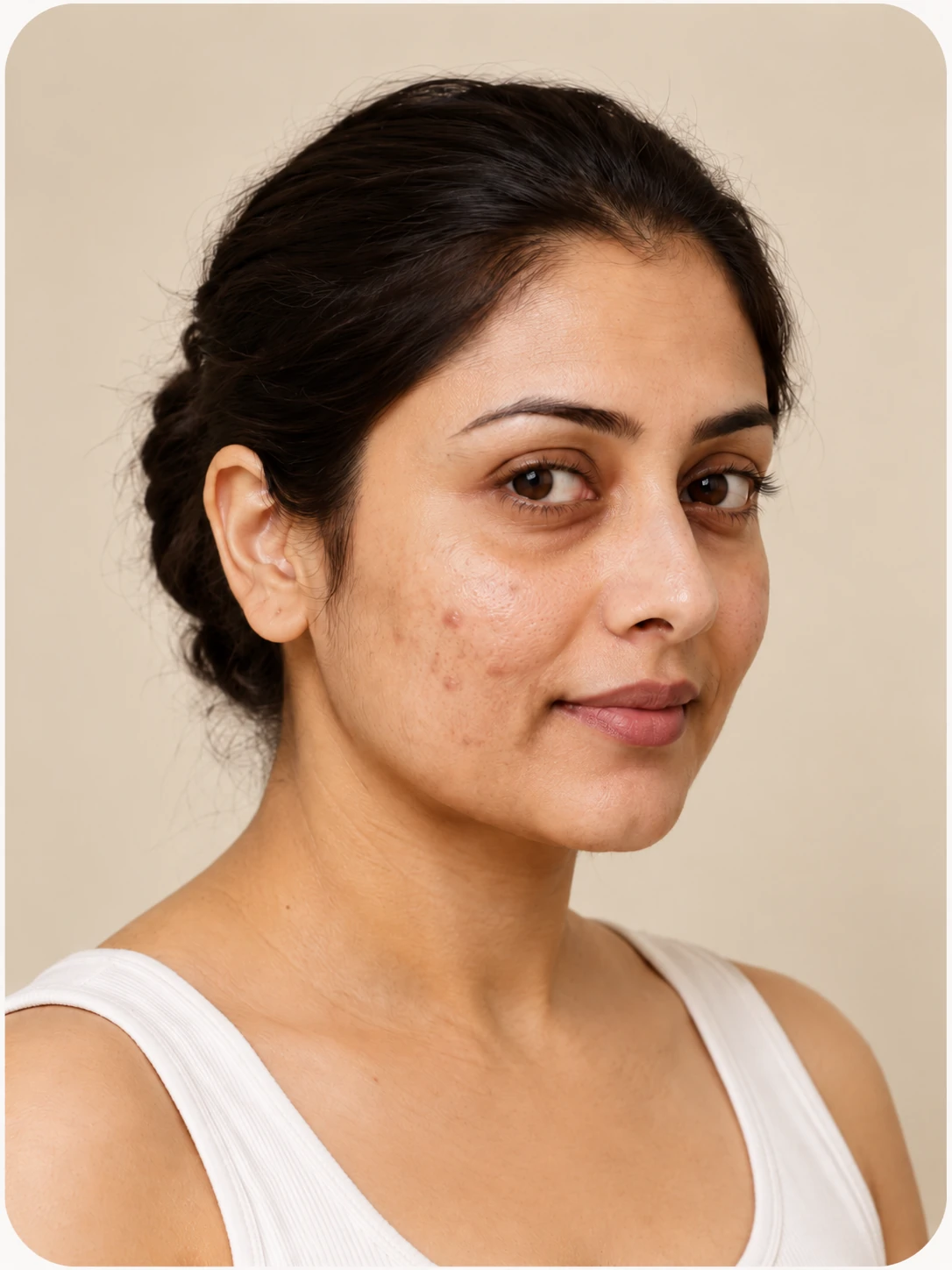 Dermatology Consultation, illustrative assessment example