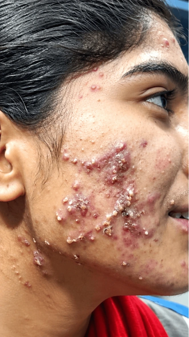 Exoluxe Medi-Facial, illustrative before example