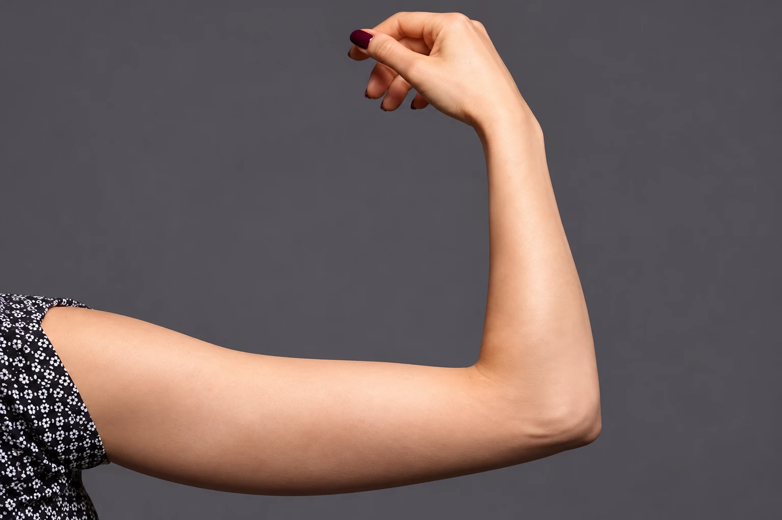 HIFU for Flabby-Arm Reduction, illustrative before example