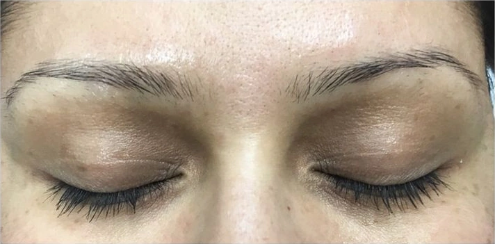 Permanent Eyebrows, illustrative before example