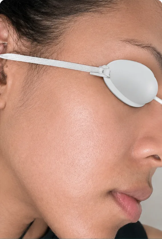 Chemical Peels — after treatment